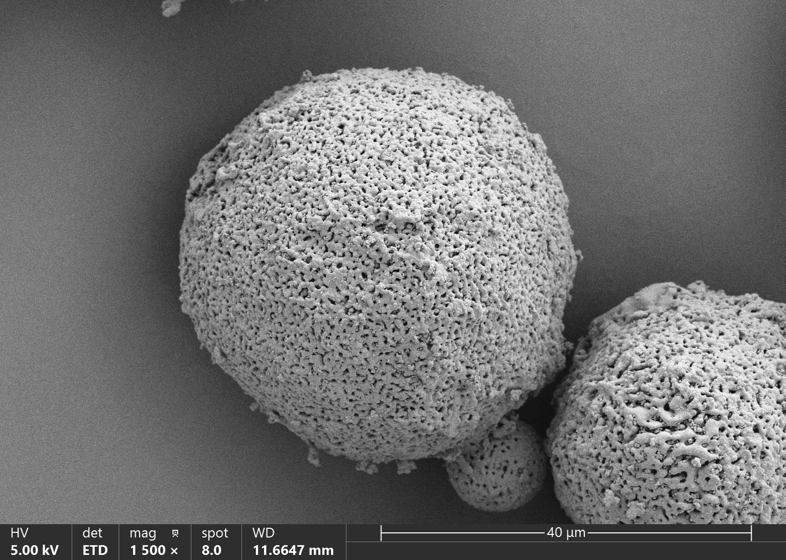 Hydroxyapatite (HAp) Microspheres for Aesthetic Injection, Type II