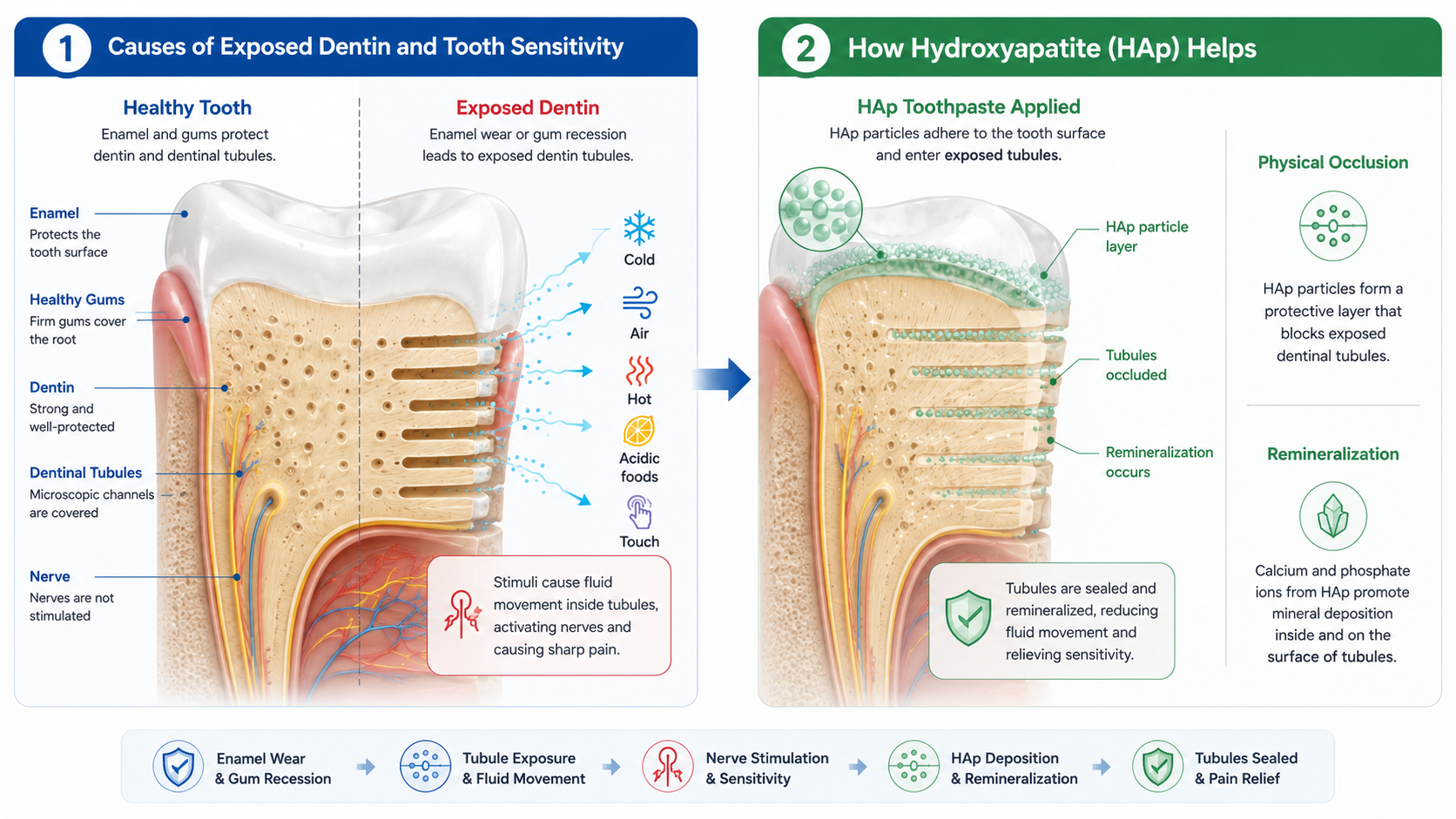 Hydroxyapatite Tooth Sensitivity Mechanism